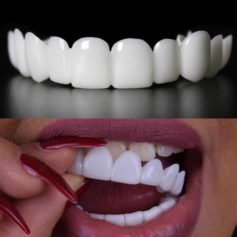 🦷 Instantly Transform Your Smile – Snap-On Veneers! 😁