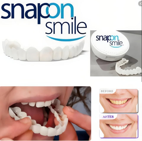 🦷 Instantly Transform Your Smile – Snap-On Veneers! 😁