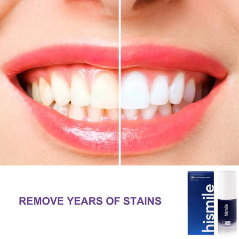 ✨ HiSmile V34 Purple Teeth Whitening Serum – Instant Stain Removal & Brighter Smile 💜😁