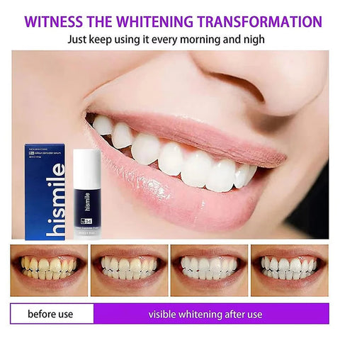 ✨ HiSmile V34 Purple Teeth Whitening Serum – Instant Stain Removal & Brighter Smile 💜😁